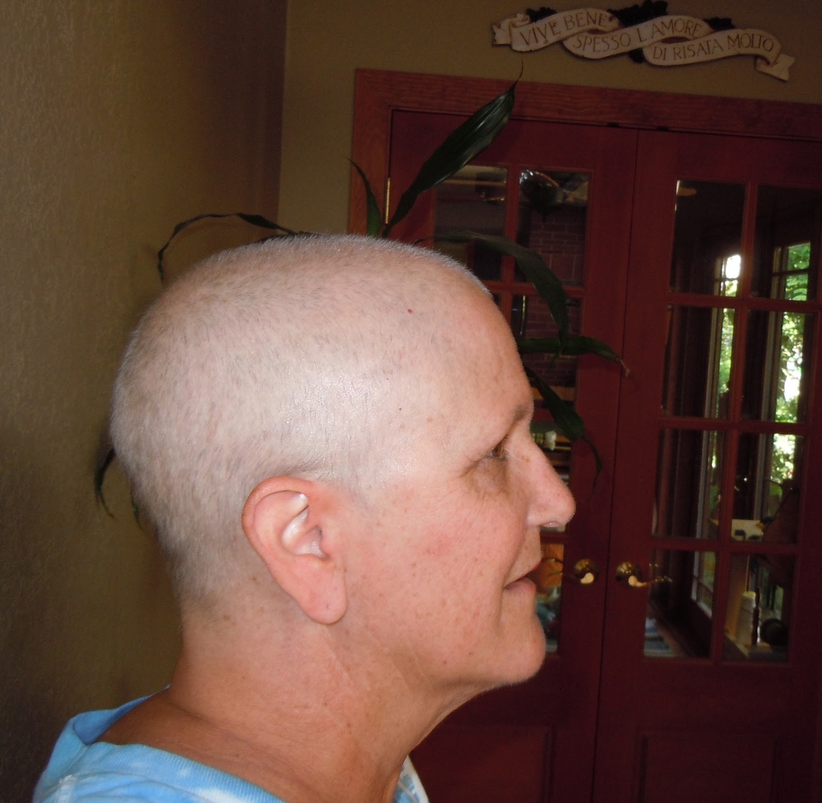 Facial hair growth after chemotherapy